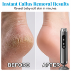 VelvaSilk™ Foot Resurfacer — Instantly Unleash Baby-Soft Feet You’ll Crave to Show Off