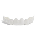 SilkSmile™ Snap-On Veneers — Unlock Instant, Effortless Confidence with a Naturally Stunning Smile