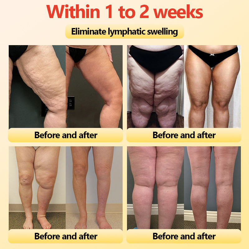 GlacioShape™ — Cozy Heat That Melts Fat, Smooths Skin & Frees You from Aches