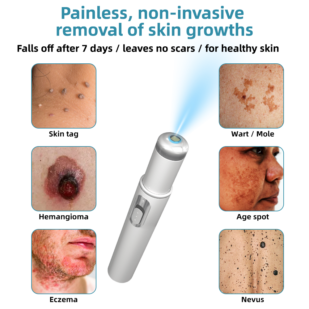SCNDR® 🏅Non-Invasive Mole and Wart Removal Laser Pen