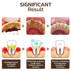 LumoraBeam™ — Unleash a Radiant Smile That Heals and Turns Heads