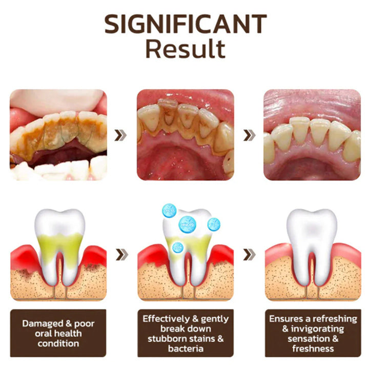 LumoraBeam™ — Unleash a Radiant Smile That Heals and Turns Heads
