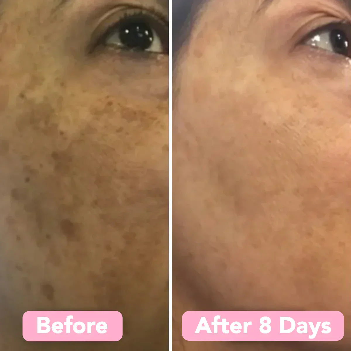 PureVera™ Turmeric Radiance Sponge — Gently Unveil Your Smoothest, Calmest Glow Every Day