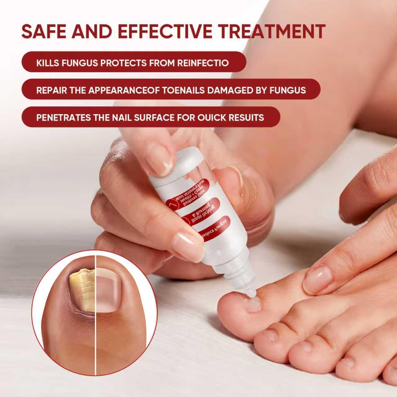SereniNail™ Antifungal Repair Drops — Reclaim Gorgeous, Strong Nails You’re Proud to Show Off