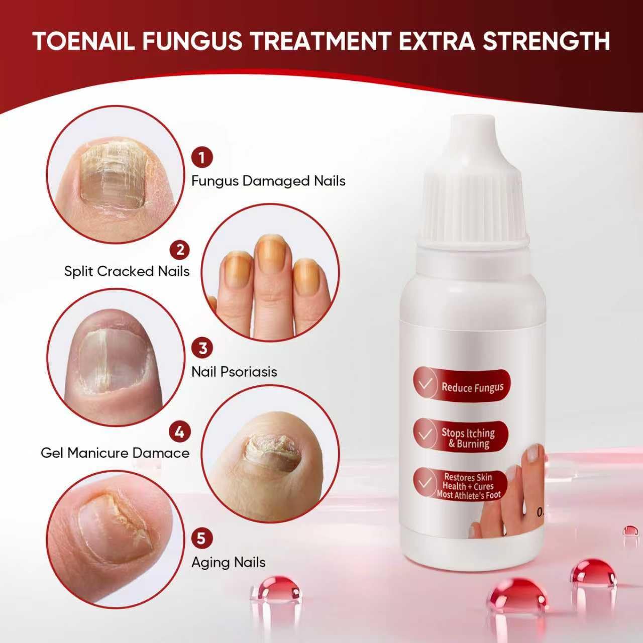 SereniNail™ Antifungal Repair Drops — Reclaim Gorgeous, Strong Nails You’re Proud to Show Off
