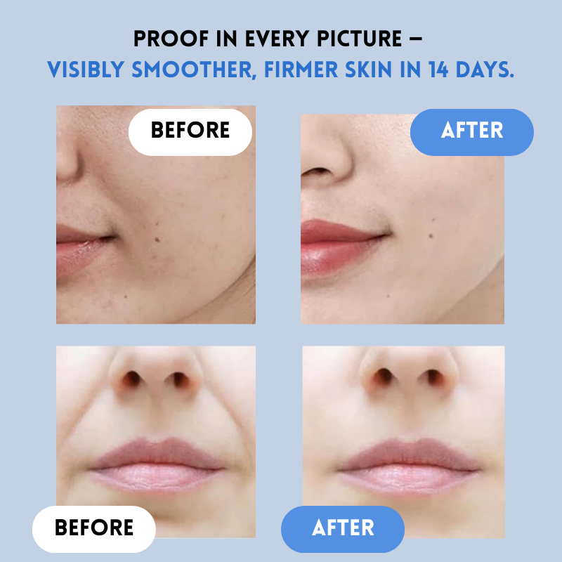 LiftEssence™ Skin Strips — Instantly Lift and Glow Like You’ve Turned Back Time