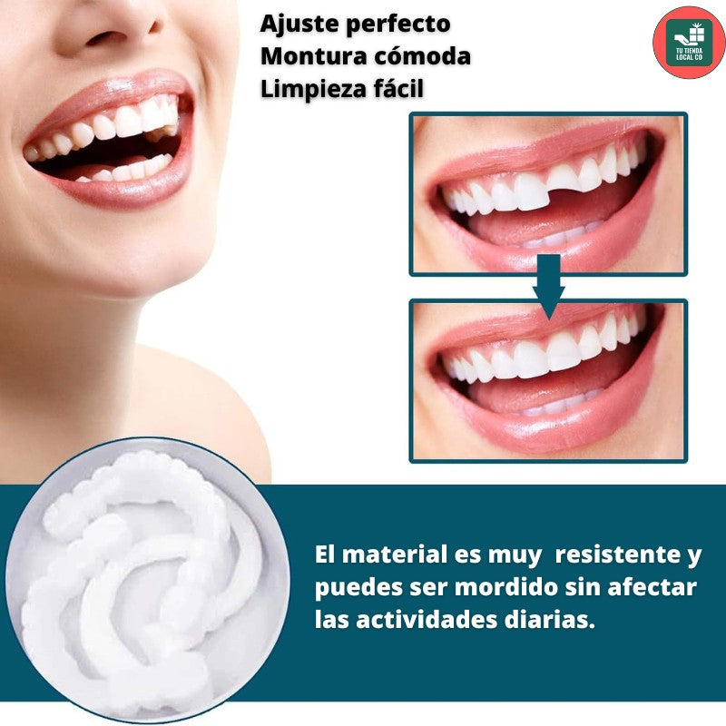 RadiantLift™ Veneers — Instantly Unlock Confidence with a Flawless, Natural-Looking Smile