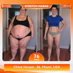 VeloSculpt™ — Ignite Fat-Burning Heat for Effortless Slimming Confidence