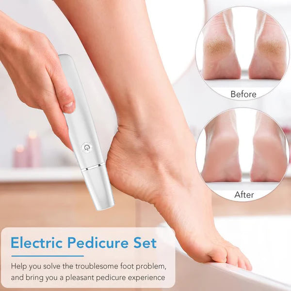 VelvetStep™ Electric Callus Remover — Unlock Silky, Pain-Free Feet You’ll Love to Show