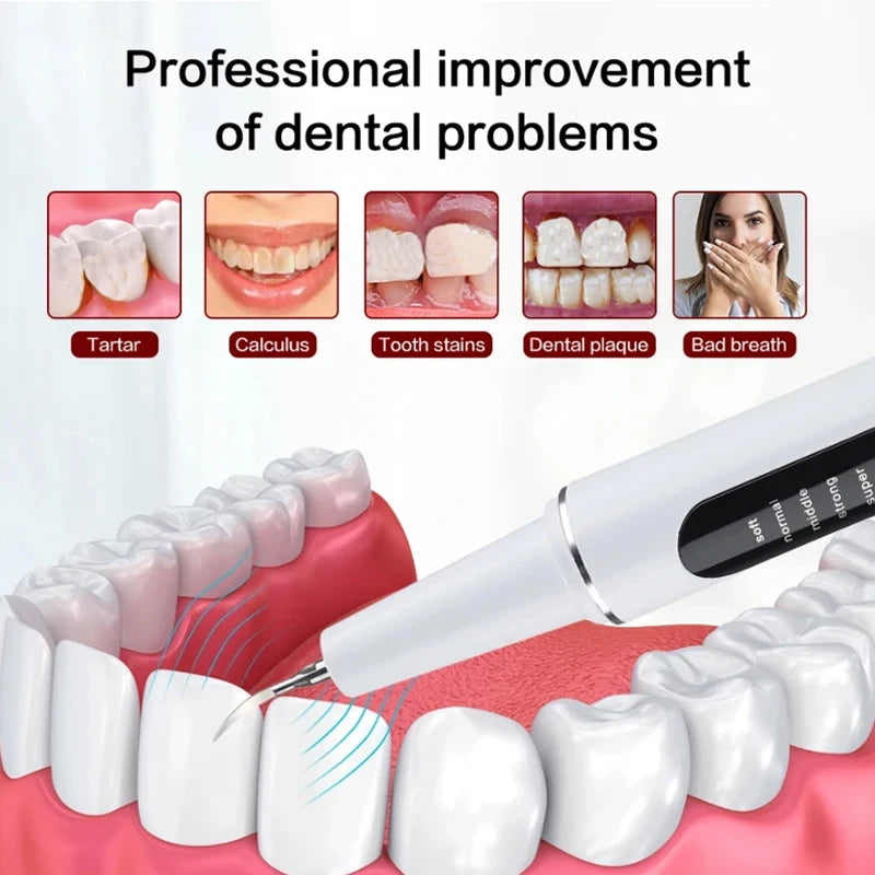 AuraShine™ Ultrasonic Scaler — Unleash a Radiant Smile That Demands Attention