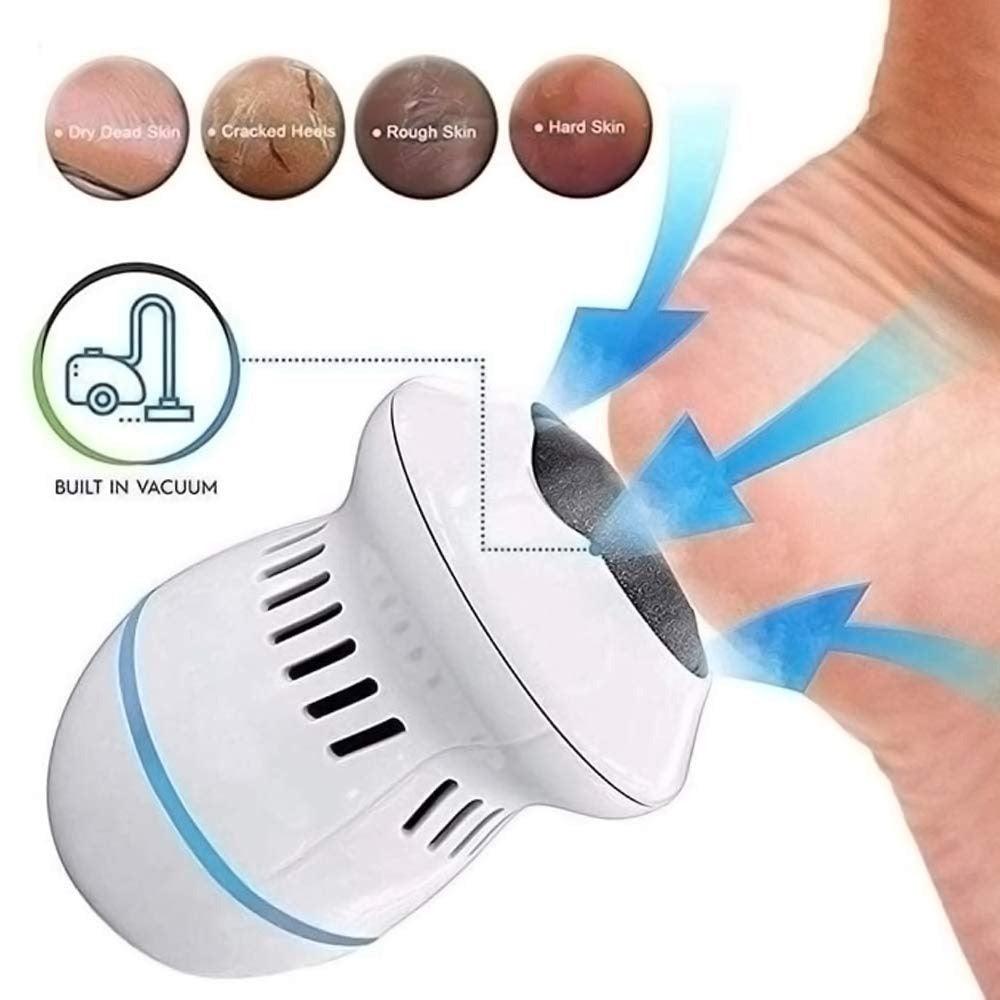 RevitaSole™ — Unlock Silky, Pain-Free Feet You’ll Love to Show Off