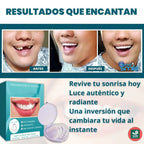 RadiantLift™ Veneers — Instantly Unlock Confidence with a Flawless, Natural-Looking Smile