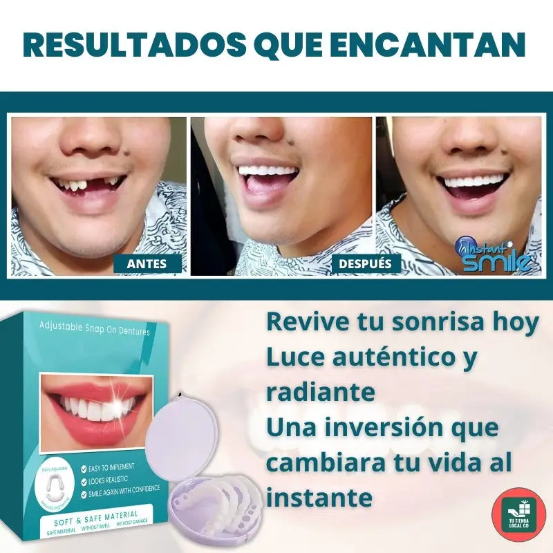 RadiantLift™ Veneers — Instantly Unlock Confidence with a Flawless, Natural-Looking Smile