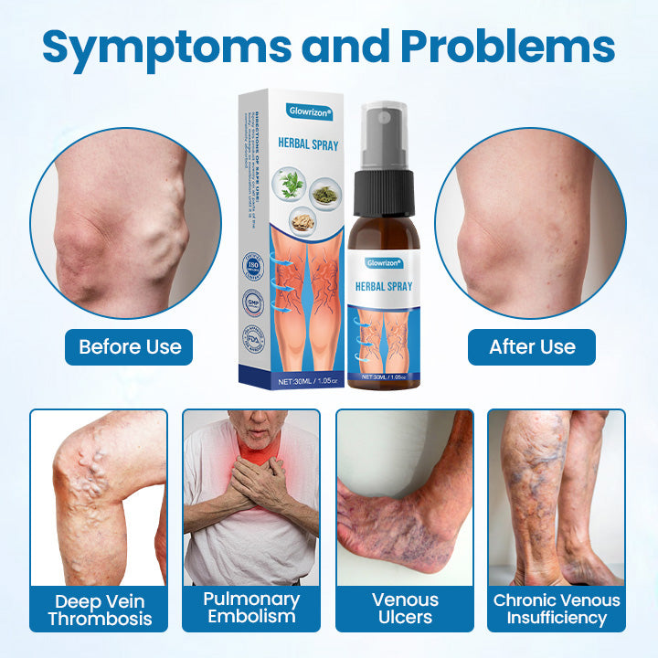 VenoSculpt™ — Transform Your Legs with Fast, Lasting Relief from Varicose Veins (1+1 FREE TODAY!)