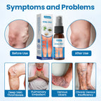 VenoSculpt™ — Transform Your Legs with Fast, Lasting Relief from Varicose Veins (1+1 FREE TODAY!)