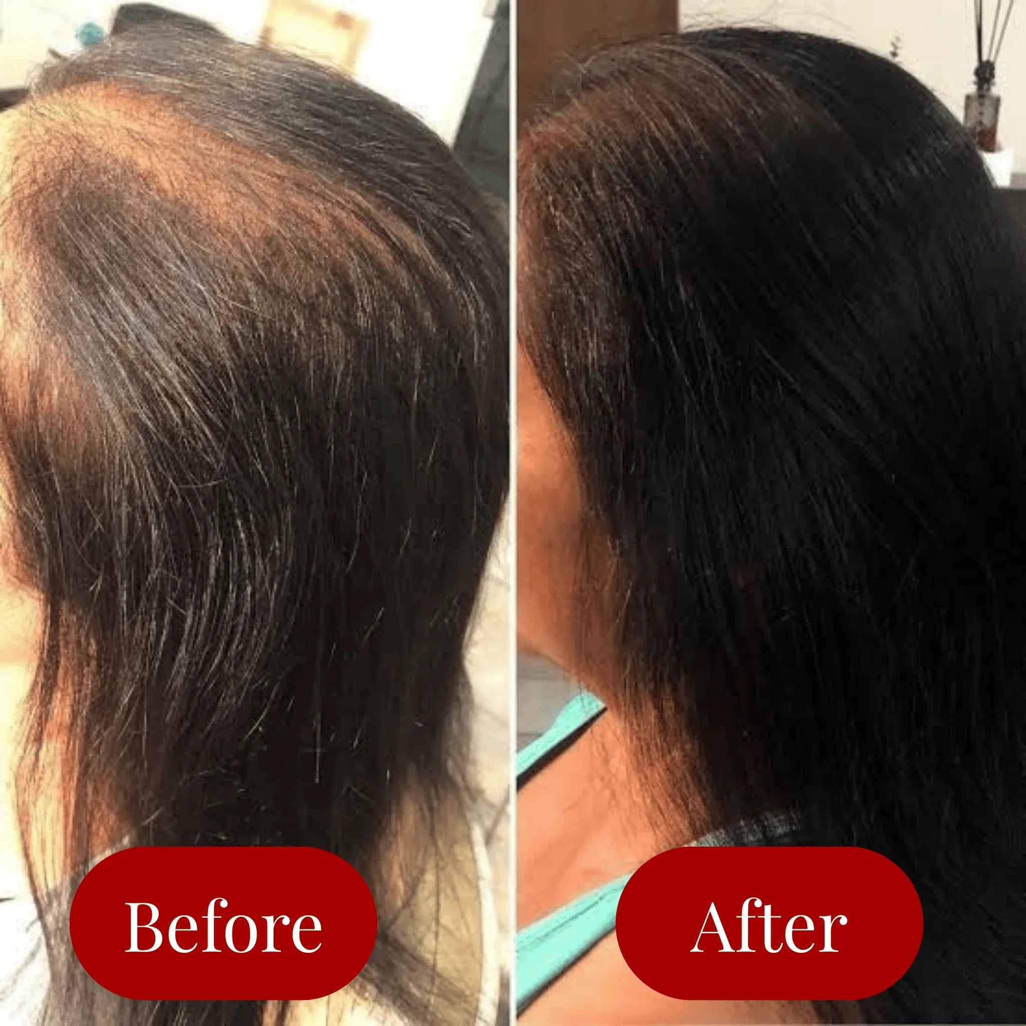 SilkAura™ Hair Elixir — Watch Your Hair Burst Into Life with Unstoppable Thickness