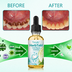 GlaciaMint™ Botanical Oral Repair Drops — Crush Bad Breath and Soothe Gums for Fresh Confidence All Day