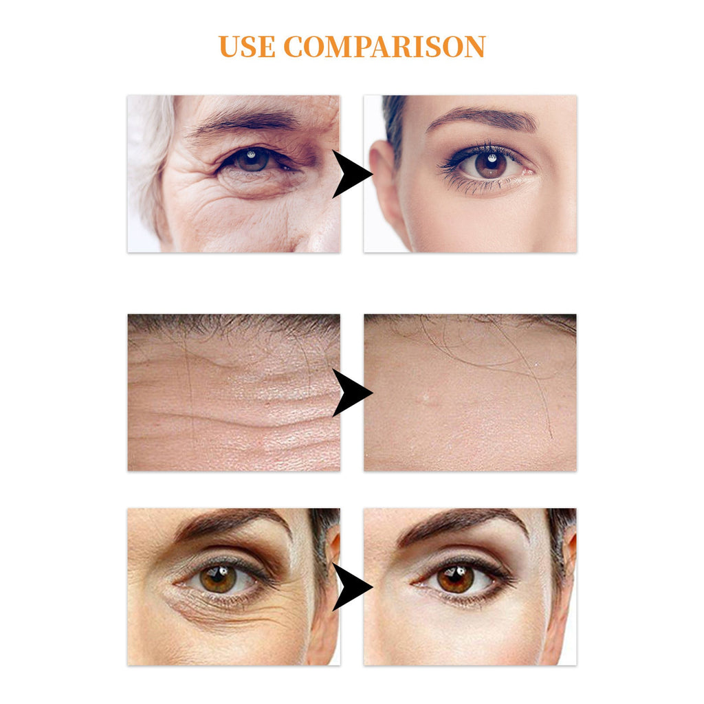 HydraLift Pro™ Eye Mask — Instantly Revive and Age-Defy Tired Eyes with Firm Hydration (10 Pieces)