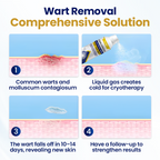 BumpFreeze™ — Help Restore Smoother-Looking Skin with Fast Cryo Care