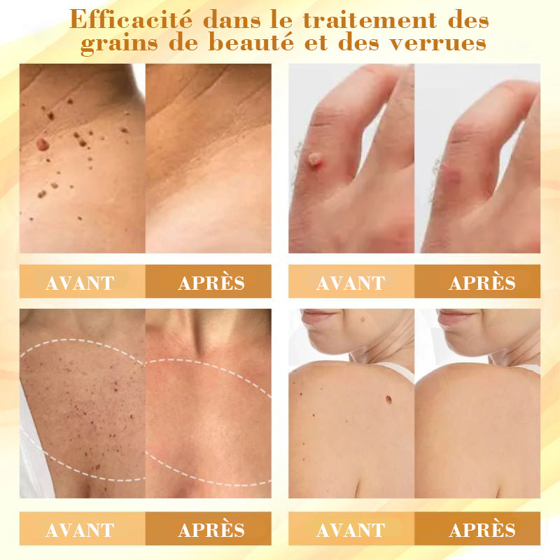 LuminaVex™ — Melt Away Skin Bumps and Unleash Your Natural Glow