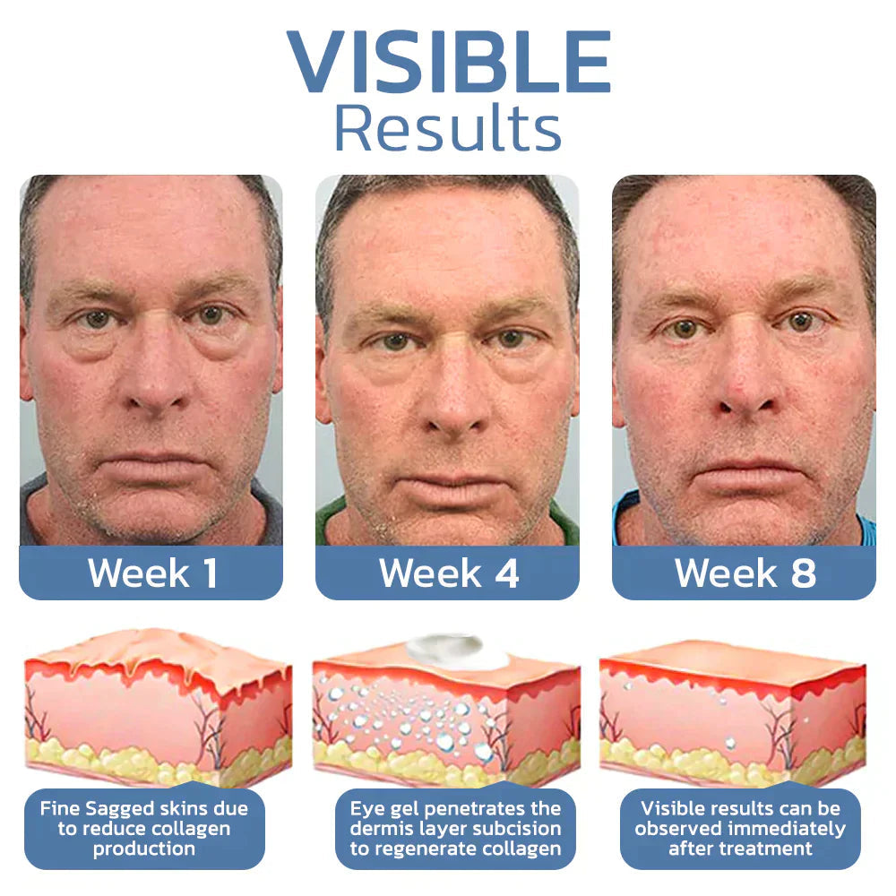 RameraLift™ — Wake Up to Younger, Brighter, and Firm Eyes Instantly (1+1 FREE TODAY!)