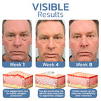 RameraLift™ — Wake Up to Younger, Brighter, and Firm Eyes Instantly (1+1 FREE TODAY!)