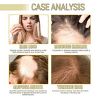 FloraLux™ — Unlock Thick, Silky Hair That Turns Heads Fast (1+1 FREE TODAY!)