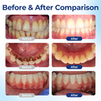 RevivaGum™ Elixir — End Gum Pain Fast and Reveal a Confident, Powerful Smile