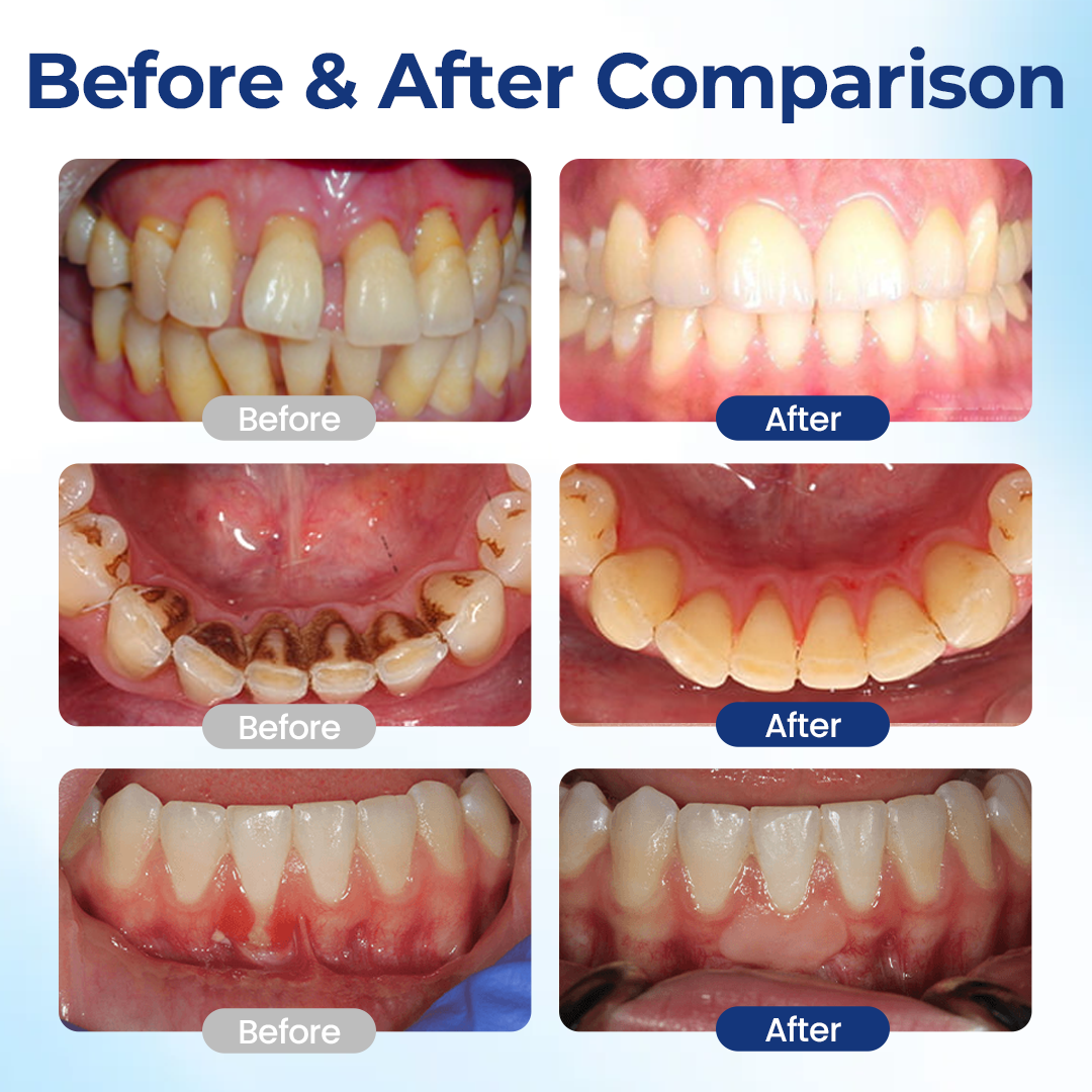 RevivaGum™ Elixir — End Gum Pain Fast and Reveal a Confident, Powerful Smile