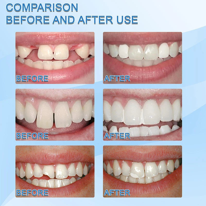 DentaForm™ — Slip On a Perfect Smile That Feels 100% Natural and Unstoppable