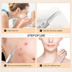 DermaSculpt™ Tweezers Set — Unlock Flawless, Confident Skin with Precise, Pain-Free Extraction