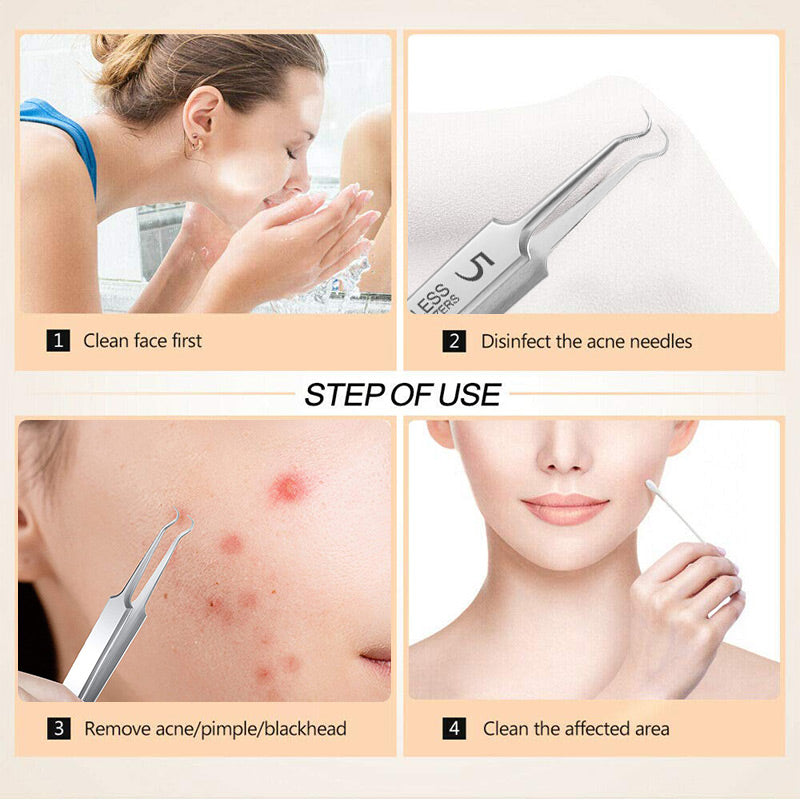 DermaSculpt™ Tweezers Set — Unlock Flawless, Confident Skin with Precise, Pain-Free Extraction