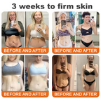VitaFirm™ — Unleash Rock-Hard, Youthful Skin That Turns Back Time (1+1 FREE TODAY!)