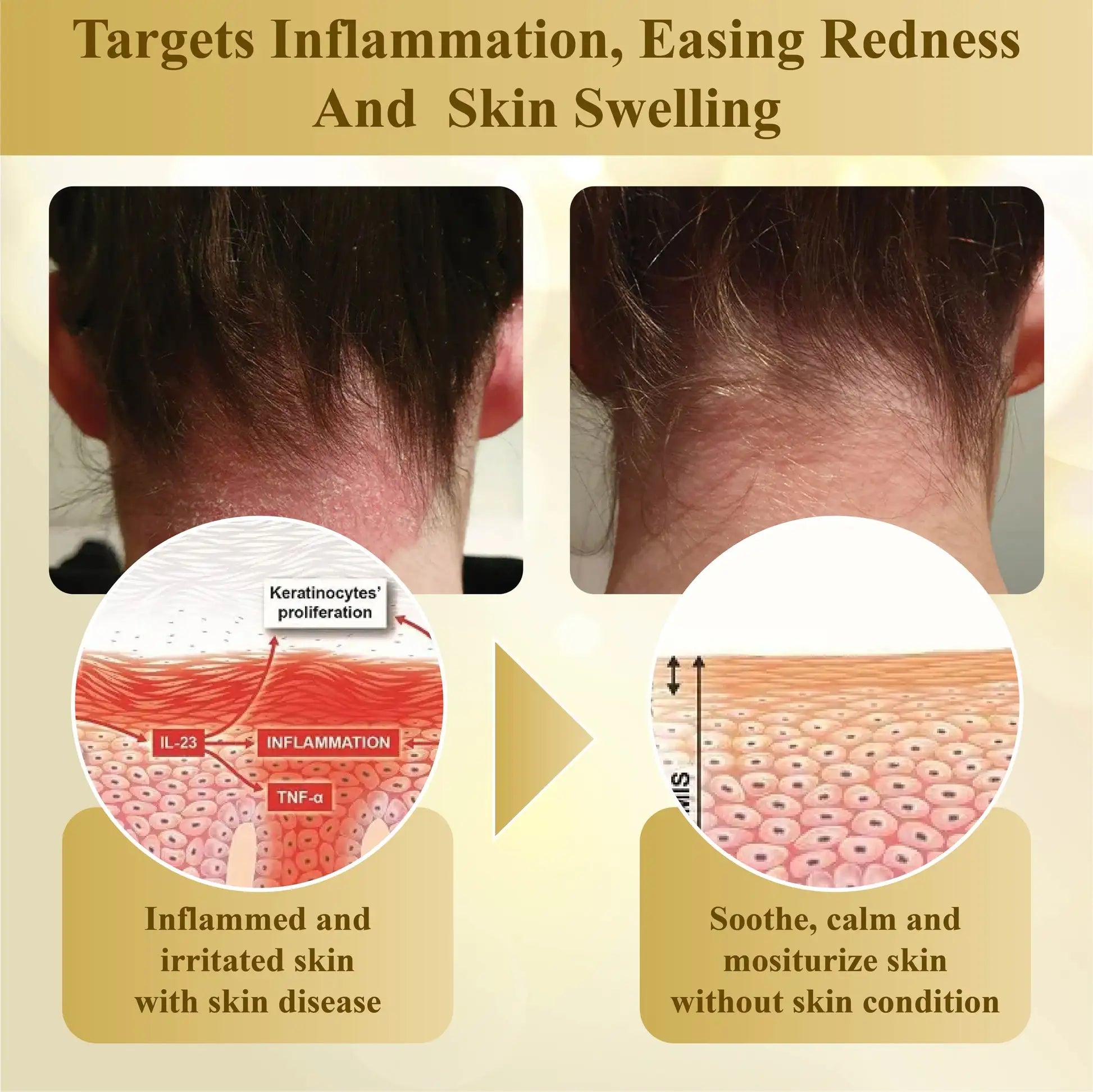 LuminaVex™ — Melt Away Skin Bumps and Unleash Your Natural Glow