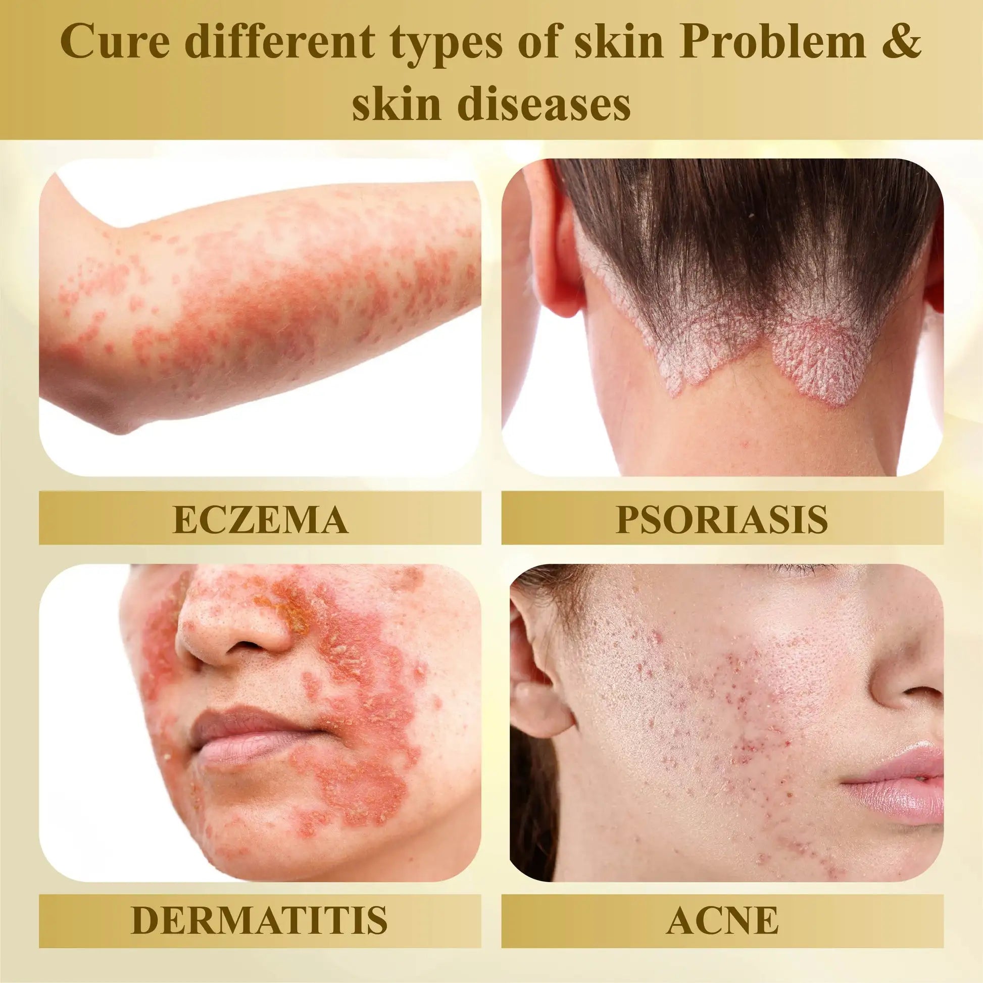 LuminaVex™ — Melt Away Skin Bumps and Unleash Your Natural Glow