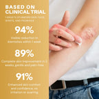 LuminaVex™ — Melt Away Skin Bumps and Unleash Your Natural Glow