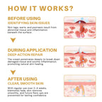 LuminaVex™ — Melt Away Skin Bumps and Unleash Your Natural Glow