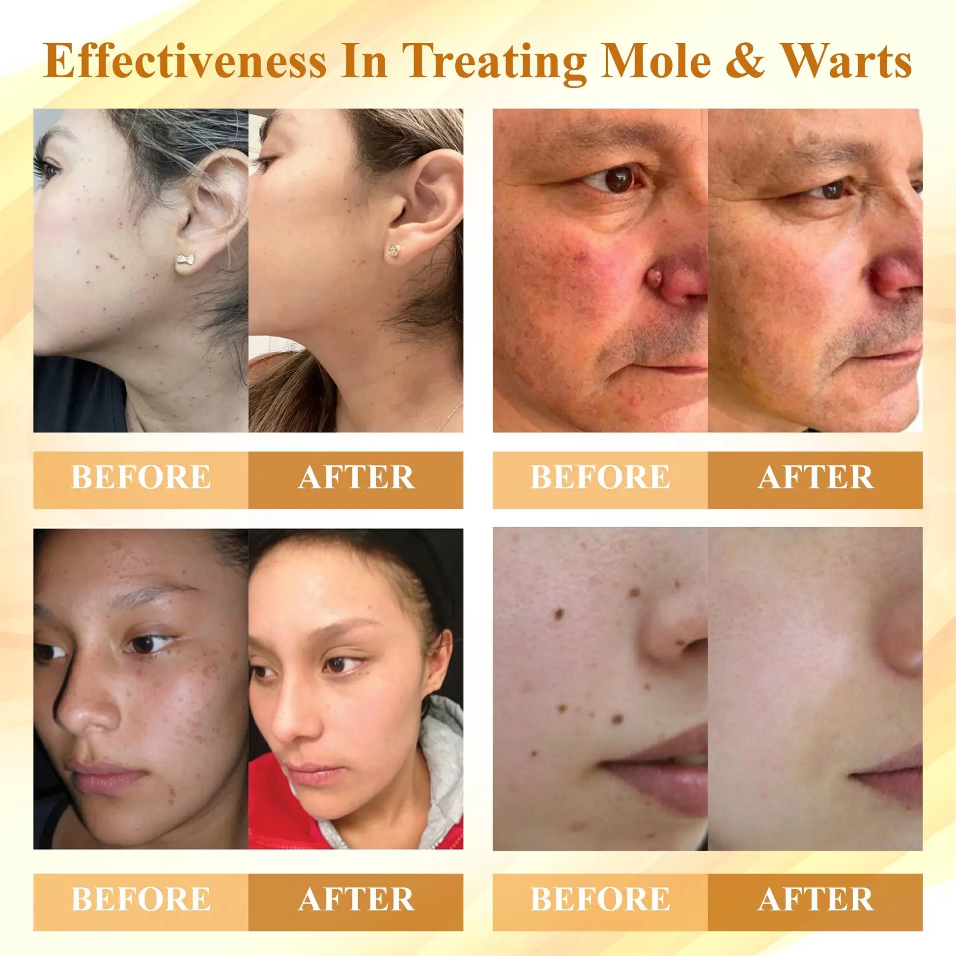 LuminaVex™ — Melt Away Skin Bumps and Unleash Your Natural Glow