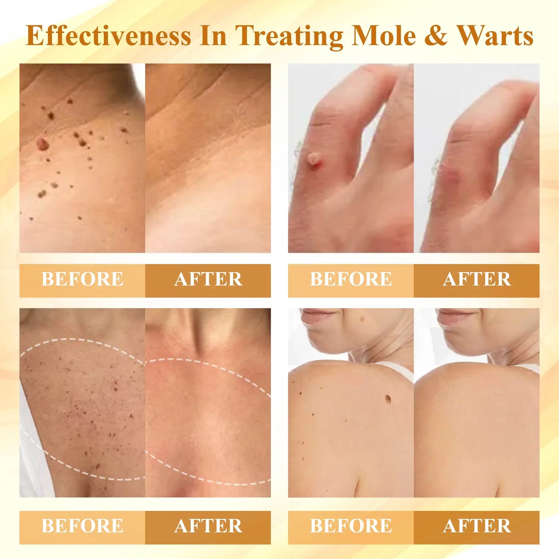 LuminaVex™ — Melt Away Skin Bumps and Unleash Your Natural Glow