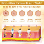 LuminaVex™ — Melt Away Skin Bumps and Unleash Your Natural Glow