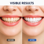 PearlBright™ Whitening Serum — Reveal a Brilliant Smile That Lights Up Every Room
