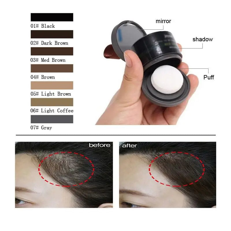 VivaRoot™ — Instantly Transform Your Hairline and Own Every Room