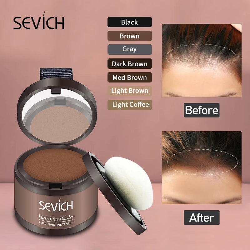VivaRoot™ — Instantly Transform Your Hairline and Own Every Room