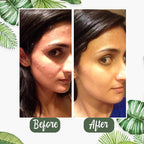 Green Tea Deep Cleanse Mask (1+1 FREE TODAY!)