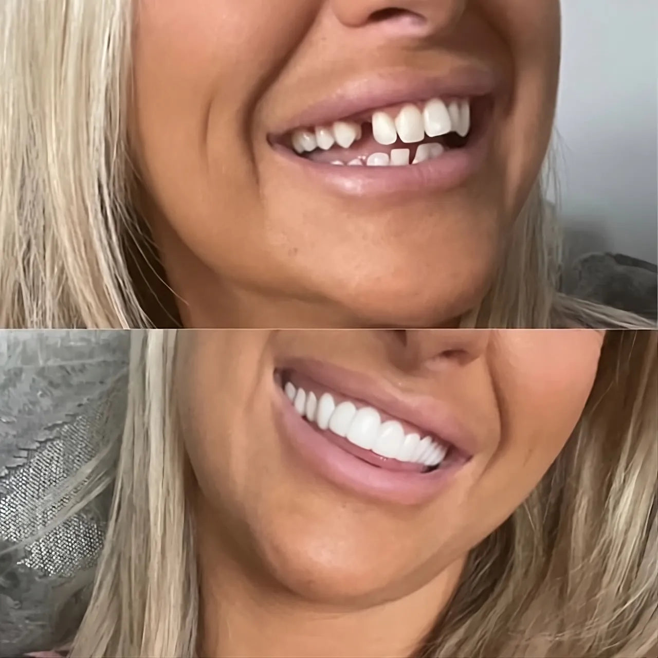 RamoraShine™ — Unlock Instant Confidence with a Radiant, Effortless Smile