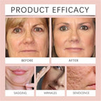 LumiFleur™ Night Renewal Mask — Wake Up to Radiant, Youthful Skin Every Morning