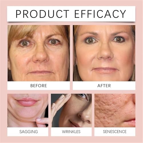 LumiFleur™ Night Renewal Mask — Wake Up to Radiant, Youthful Skin Every Morning