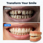 SmileForma™ — Rediscover the Freedom to Smile, Speak, and Live Confidently Every Day