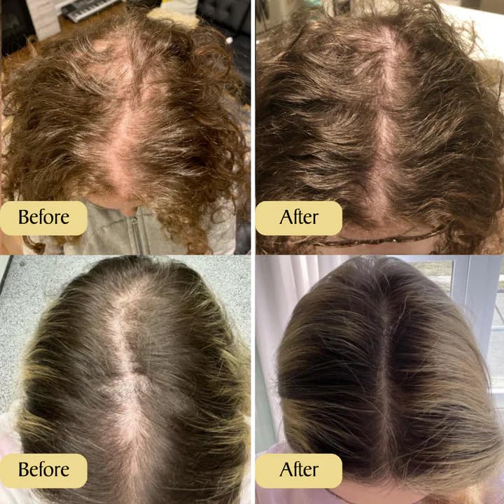 FloraLux™ — Unlock Thick, Silky Hair That Turns Heads Fast (1+1 FREE TODAY!)