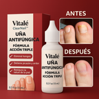 SereniNail™ Antifungal Repair Drops — Reclaim Gorgeous, Strong Nails You’re Proud to Show Off